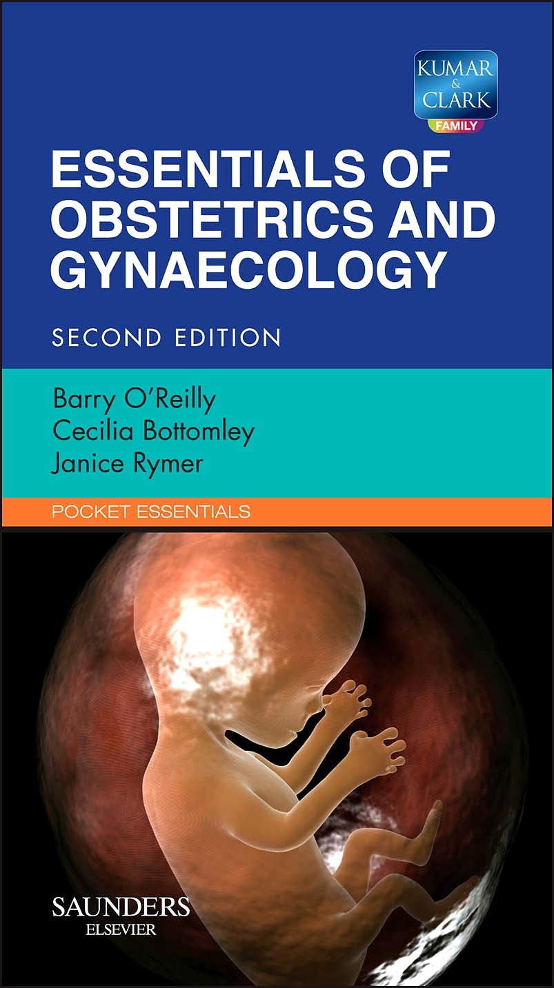 Essentials of Obstetrics and Gynaecology (Pocket Essentials ...