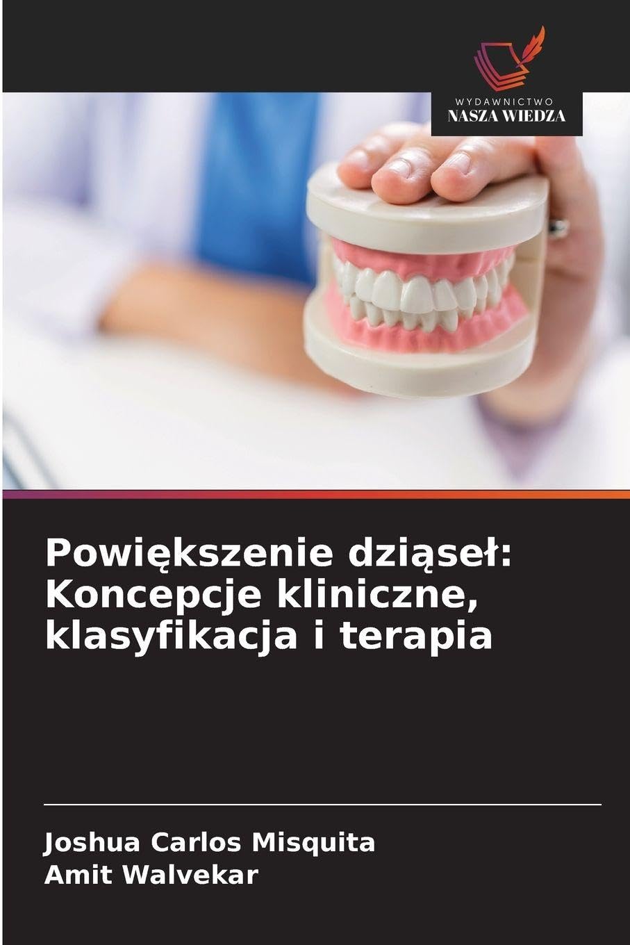 Powiększenie dziąsel: Koncepcje kliniczne, klasyfikacja i terapia