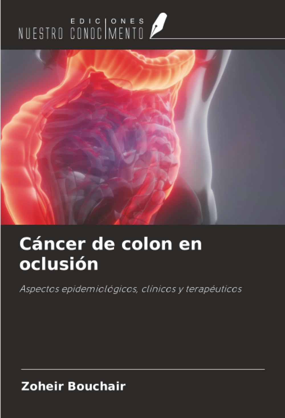 Cáncer de colon en oclusión: Aspectos epidemiológicos, clínicos y terapéuticos
