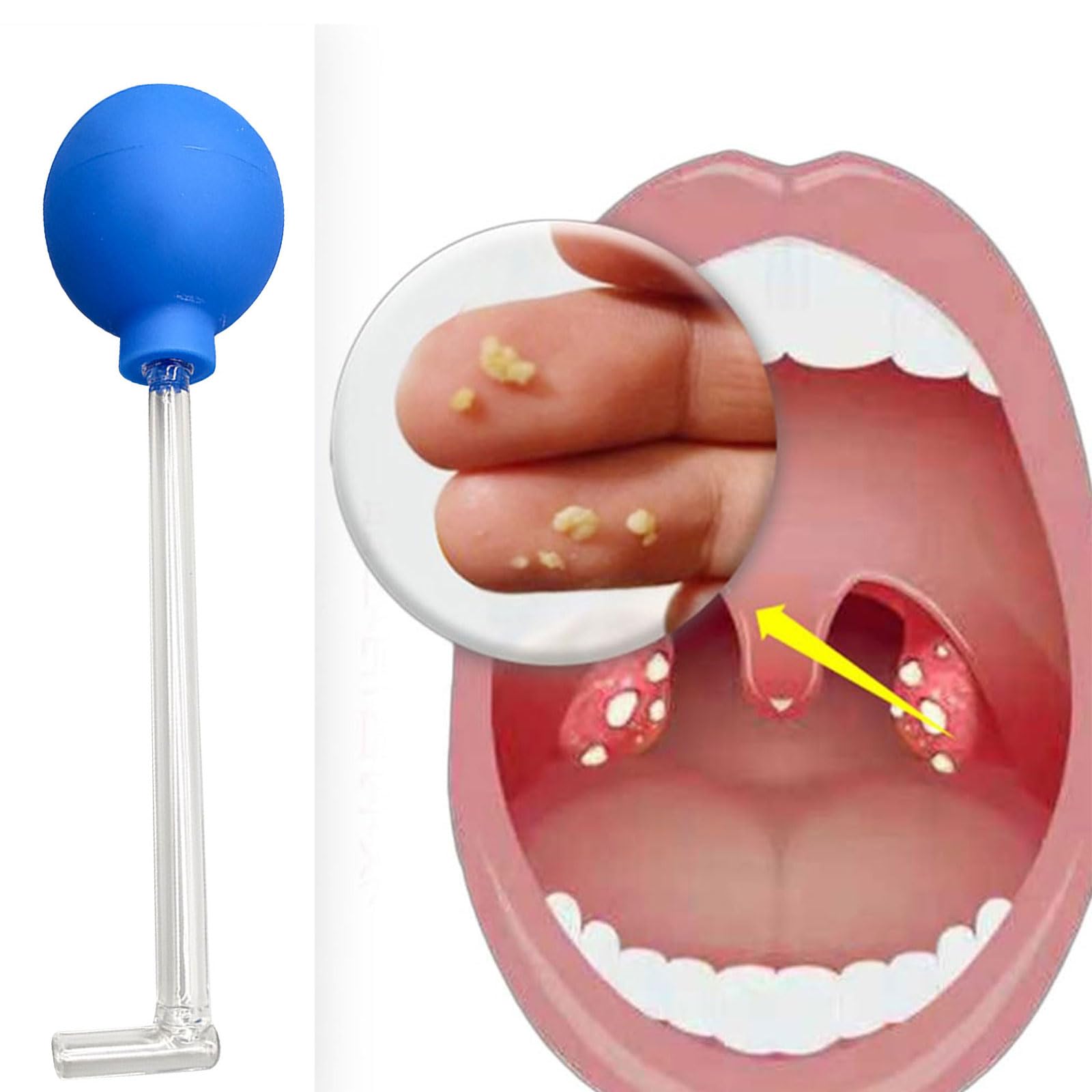 Ventouse En Verre Pour Enlever Les Calculs D'Amygdales - Outil Hygiène Bucco-Dentaire Doux Et Efficace