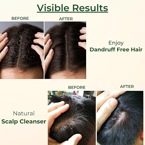 Miniatura 6 de CULTIVATOR'S Champú seco para el cabello a base de hierbas con amla y carbón en polvo, 8.81 onzas, natural, anticaspa, purificante, orgánico