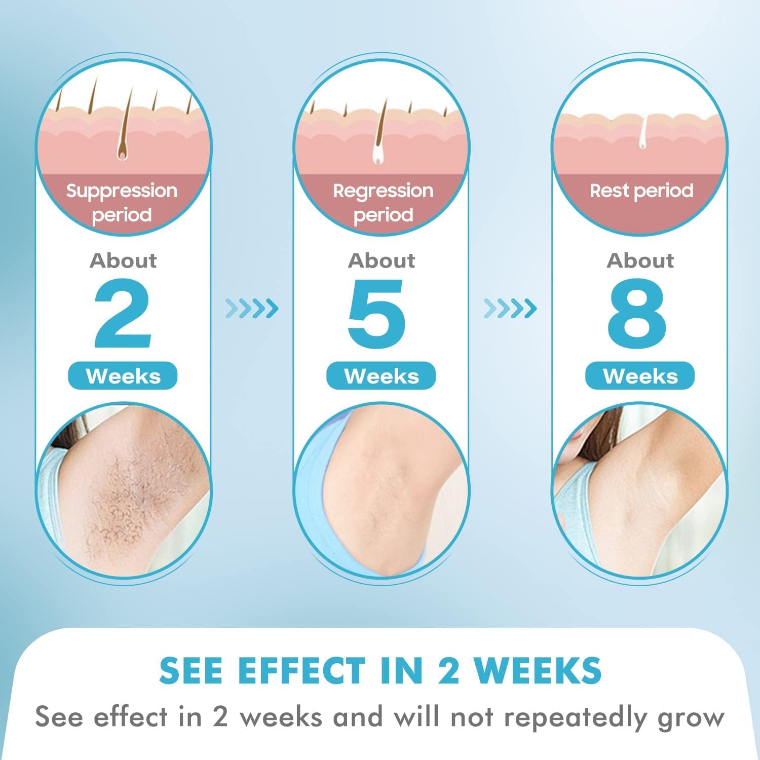 Home Hair Removal for Women and Men, DOPI Permanent Painless Ice Cooling Painless Hair Removal Device with Sapphire Cooling, Safe and Long-Lasting for Reducing in Hair Growth for Body & Face