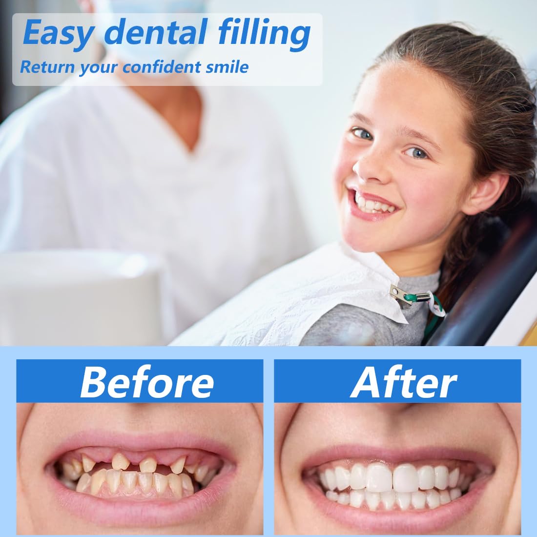 GXGM 100g Cemento per Denti Perline Temporanee di Riparazione dei Denti,Kit Riparazione Denti,Materiale di Riempimento Dei Denti Dental per Otturazioni,Cavità e Denti Scheggiati