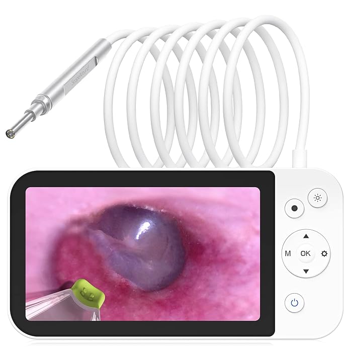 Buy Digital Otoscope with Light, Ear Camera with Ear Wax Removal Tool