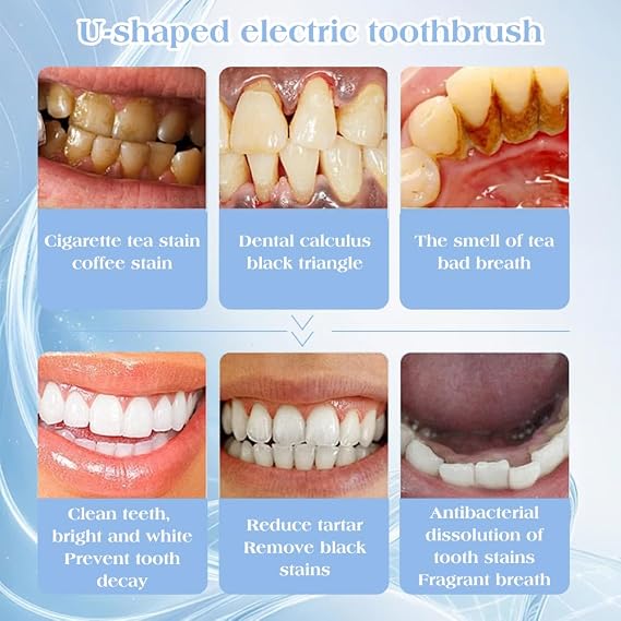 U-Shaped Toothbrush, Fully Automatic U-Shaped Sonic Toothbrush, 360° Deep Cleaning, 3 Cleaning Modes, LED Blue Light, Fully Automatic Waterproof Oral Care