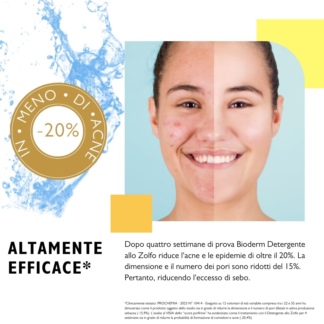 Bioderm S Detergente allo Zolfo 1,5% – Detergente Viso e Corpo per Pelle Grassa e Impura, Acne e Punti Neri – Azione Purificante e Sebo-Normalizzante – 300 ml con Erogatore