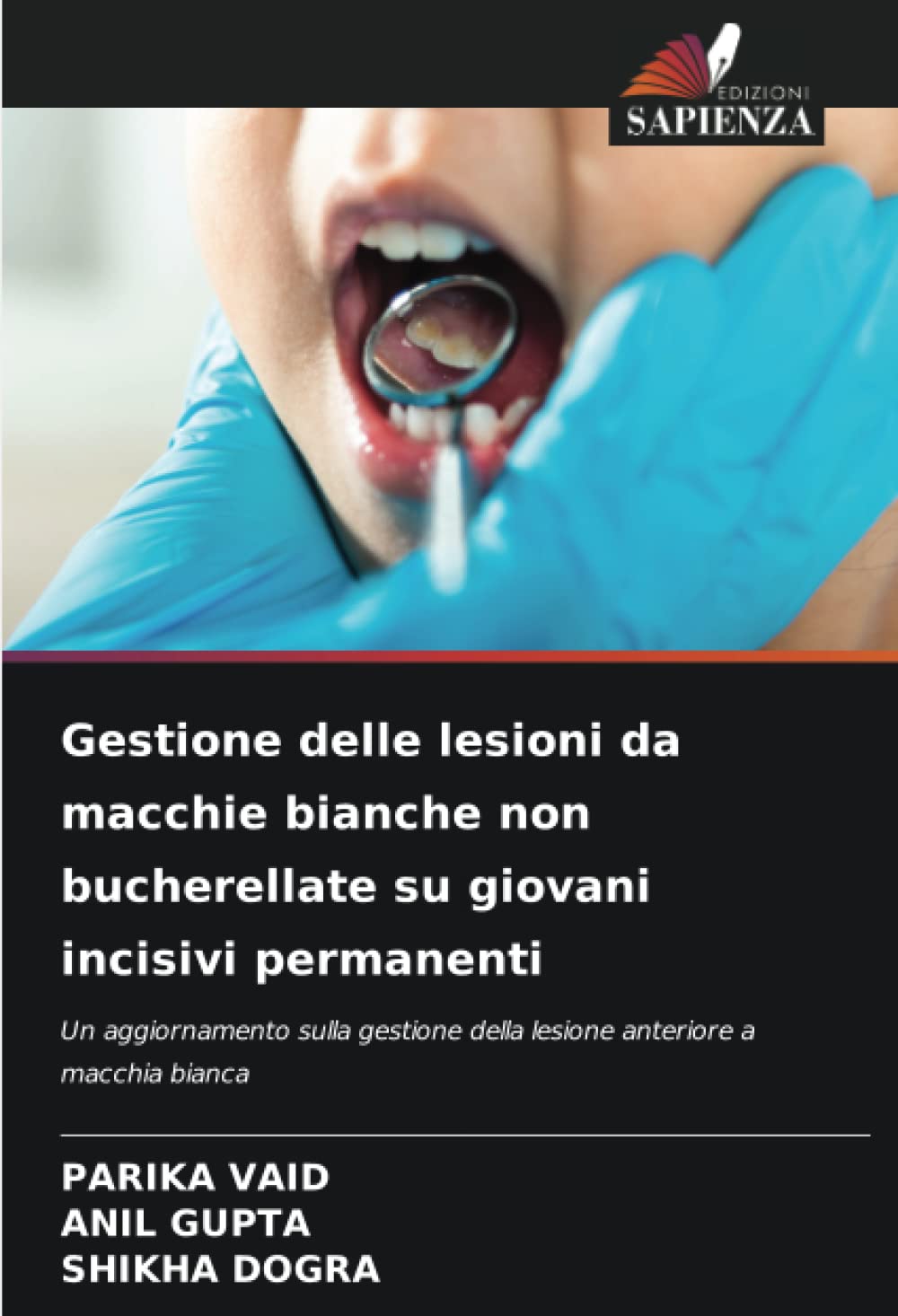 Gestione delle lesioni da macchie bianche non bucherellate su giovani incisivi permanenti
