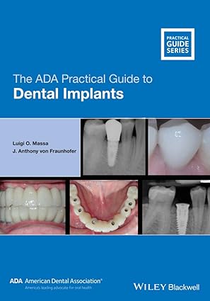 The ADA Practical Guide to Dental Implants