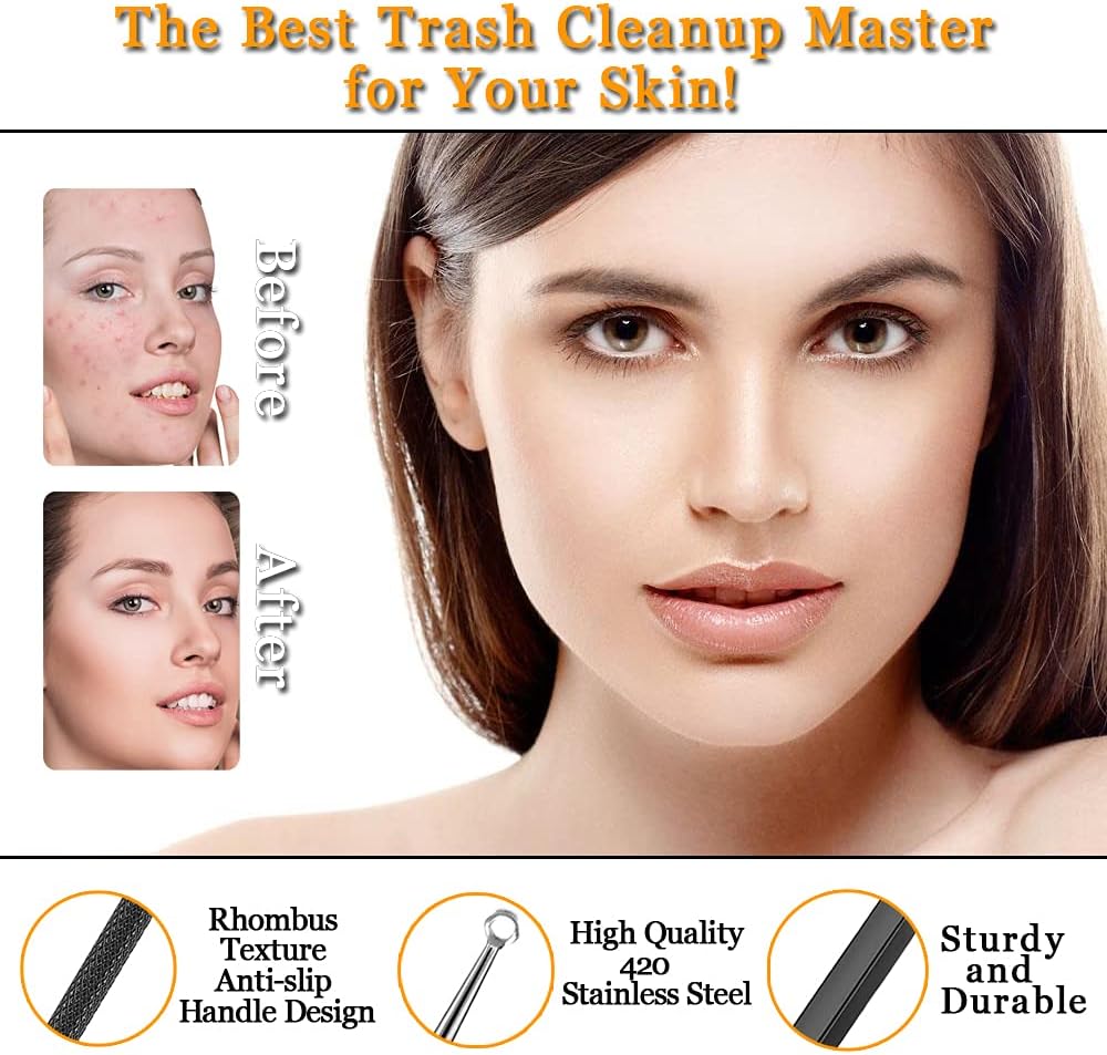 Xesscare Pimple Popper Tool Kit 16 Pcs Blackhead Remover Tool Comedones Tweezers Acne Extractor Blemish Whitehead Removal Tool for Facial, Nose and Forehead Black : Beauty & Personal Care