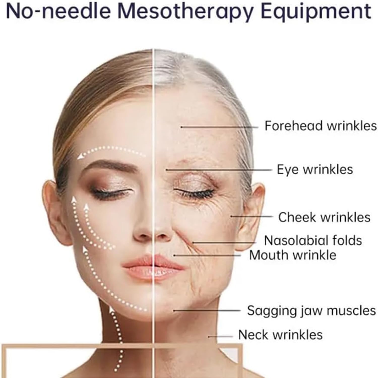 Machine de microdermabrasion diamant 65 W, appareil de beauté par radiofréquence, fréquence d'alimentation 3 MHz, fréquence RF 5 MHz, pompe à vide 100 PA, pour exfoliant, régénérateur de peau