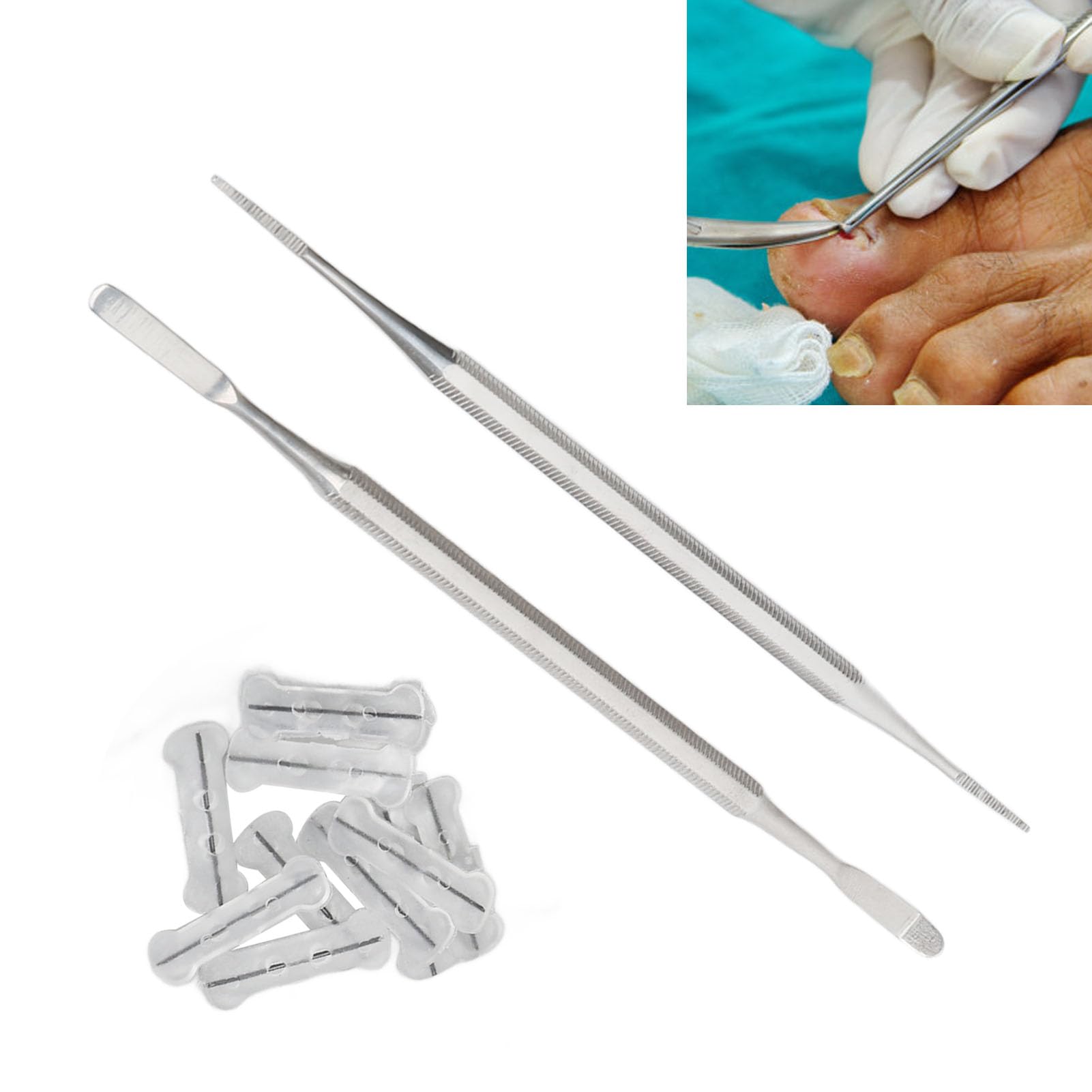 Kuuleyn Ingrown Toenail Correction Kit Alloy Stainless Steel Includes 10PCS 20mm Corrector Strips Brace Double Ended Pedicure File and Toenail Lifter for Home Pedicure
