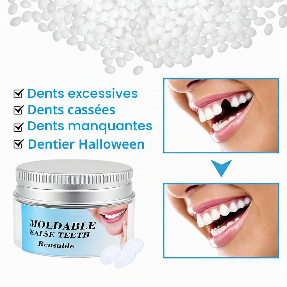 Kit de Réparation Dentaire, Pâte à Moulage Temporaire, Combleur d'Interdents DIY, Gel Granuleux pour Prothèses Dentaires et Petites Réparations