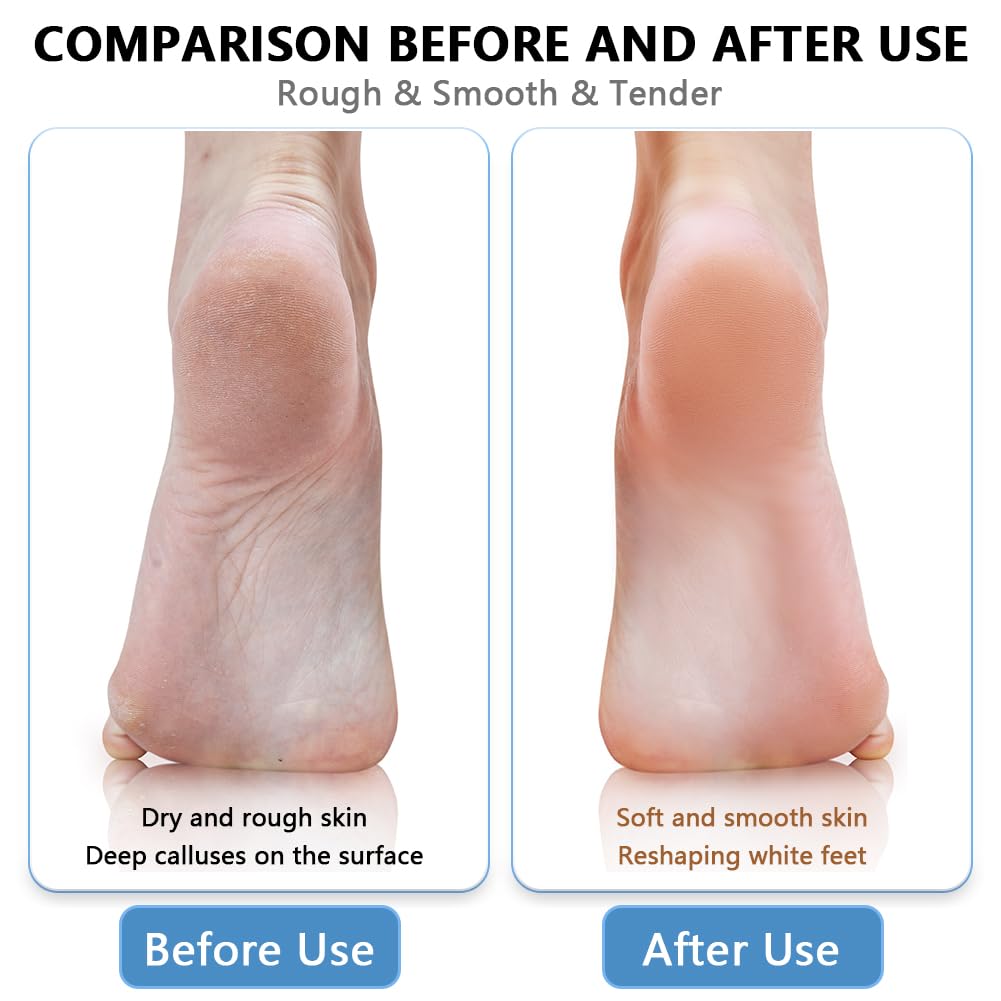 OSDUE Lima Pies De Vidrio Nano 2en1, Profesional Raspador Eliminación de Callos y Piel MuertaDura, Portátil Erramienta de Belleza en Húmedo y Seco para Cuidado de Los Pies para Piel Pies Agrietados