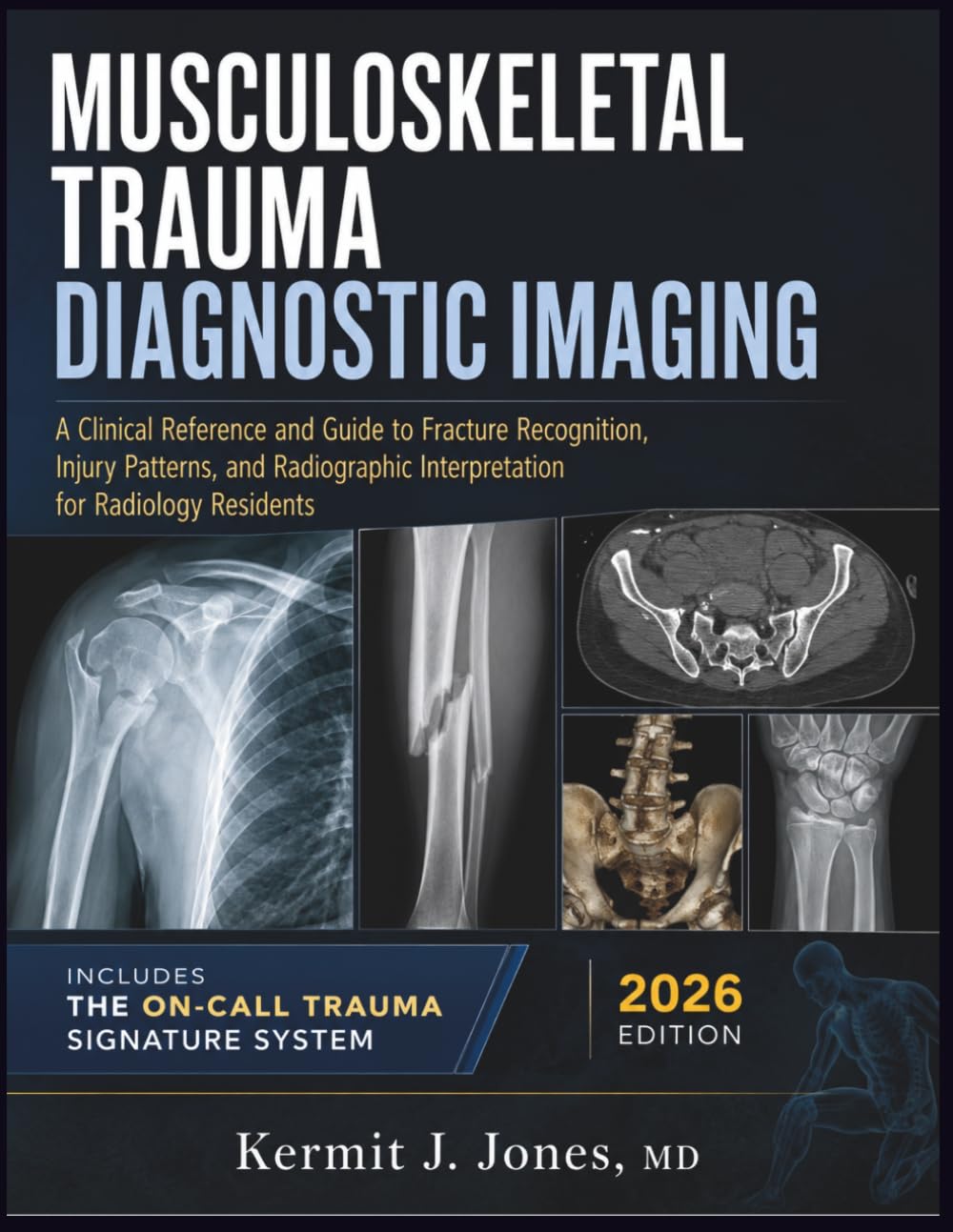 Musculoskeletal Trauma Diagnostic Imaging 2026: A Clinical Reference and Guide to Fracture Recognition, Injury Patterns, and Radiographic Interpretation for Radiology Residents