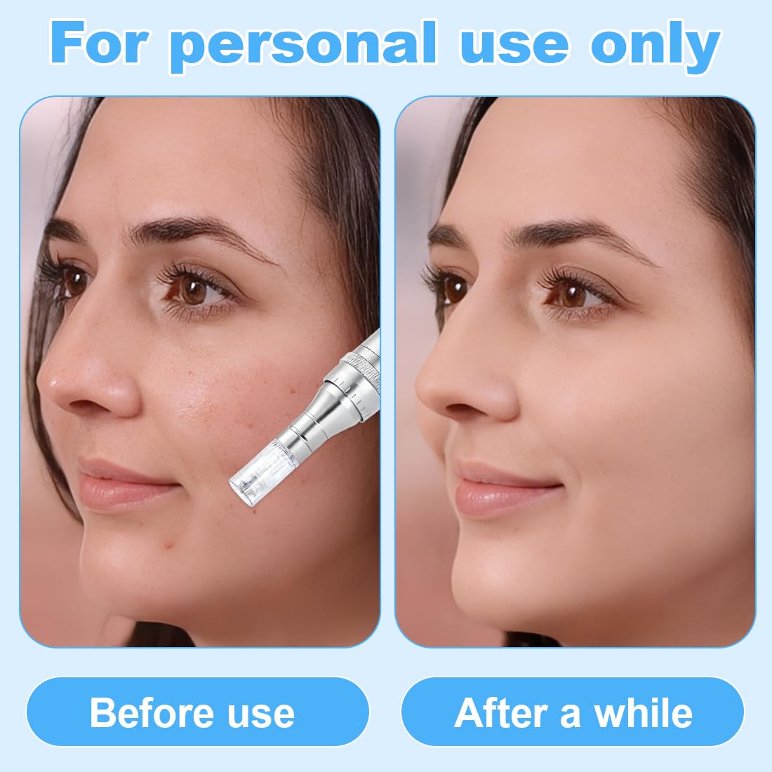 10 Pezzi 12 pin micro nano aghi per modello, aghi di ricambio per microneedling, universale compatibilità con Microneedling, microneedling viso, per il ripristino della pelle