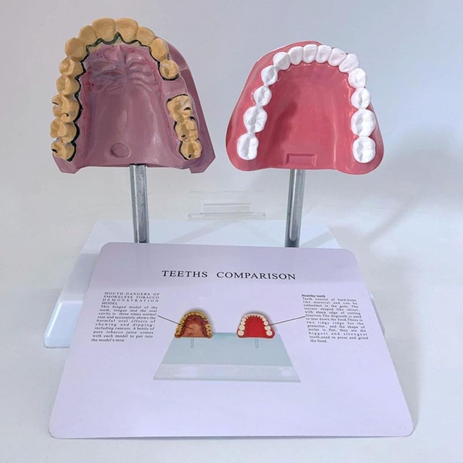 Modello Anatomico dei Denti del Orale Umano, Struttura Anatomica Accurata E Patologica, per Studenti di Odontoiatria