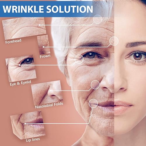 Miniatura 4 de Parches antiarrugas para la frente - Cinta facial - Cinta facial antiarrugas - Cinta antiarrugas - Línea V - Máscara facial antienvejecimiento -