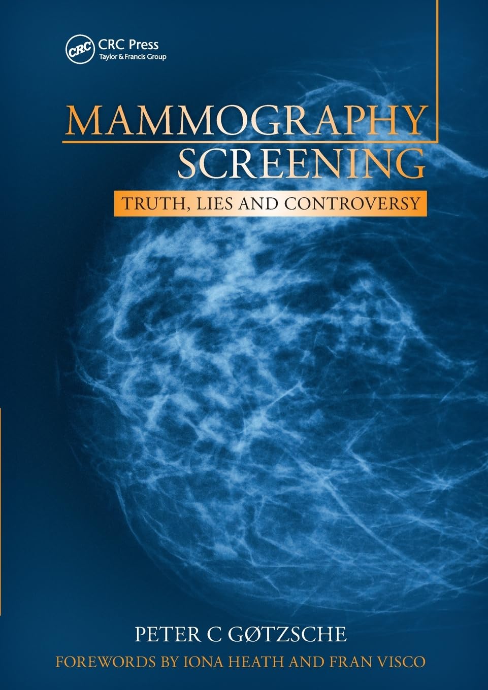Mammography Screening: Truth, Lies and Controversy 1st Edition