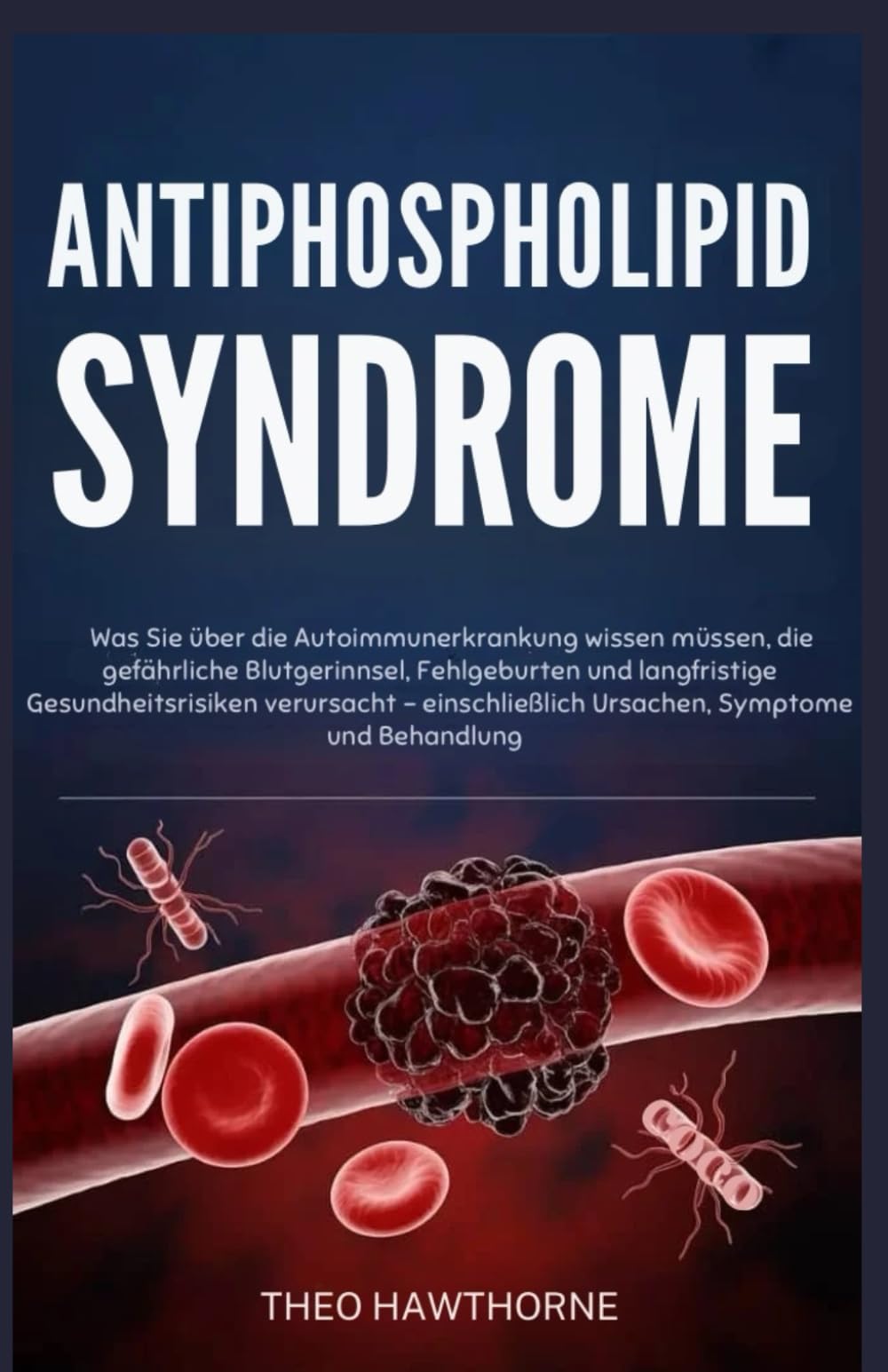 Antiphospholipid Syndrome: Was Sie über die Autoimmunerkrankung wissen müssen, die gefährliche Blutgerinnsel, Fehlgeburten und langfristige Gesundheitsrisiken verursacht – einschließlich Ursachen, Sym