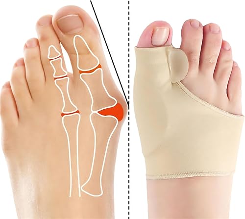 2 pares de calcetines correctores de juanetes  2023 nuevos calcetines Orthoes para alivio de juanetes para mujeres y hombres, cómodos corrector