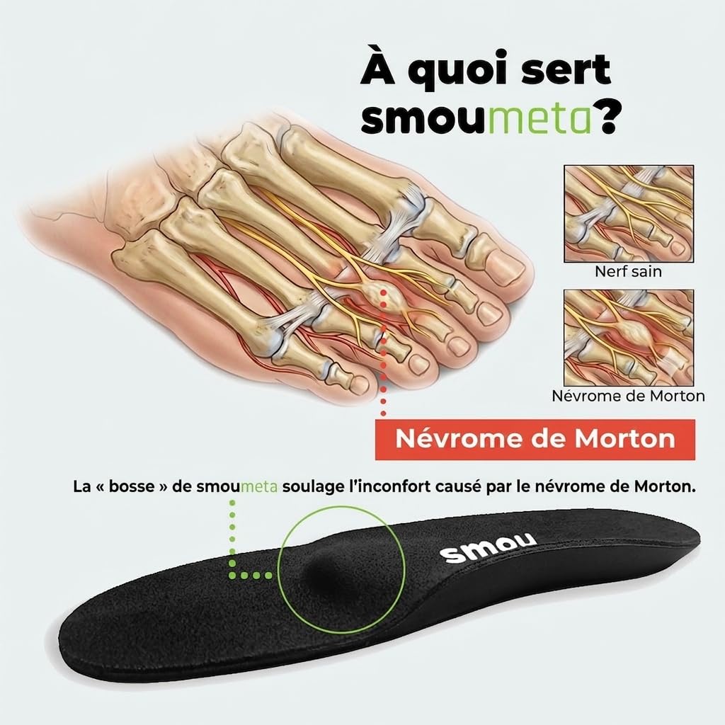 Semelles orthopédiques SMOU Meta – Métatarsalgie et névrome de Morton – Coussinet métatarsien, mousse à mémoire – Amorti, confort et soulagement de l’avant-pied – Homme et Femme