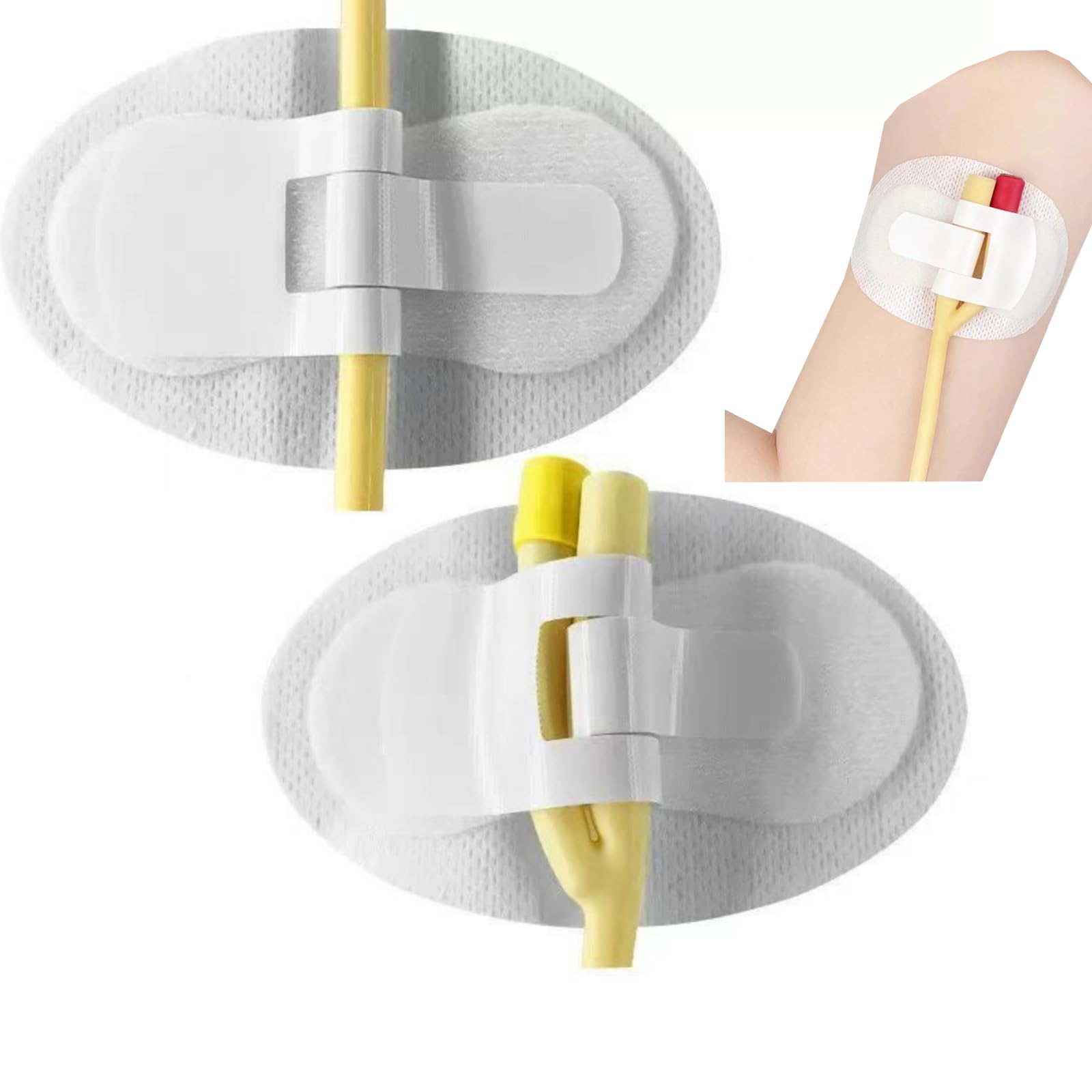 30Pcs STATLOCK Foley Catheter Stabilization Device - Reliable Adhesive Lock for Easy Foley Catheter Kit Installation