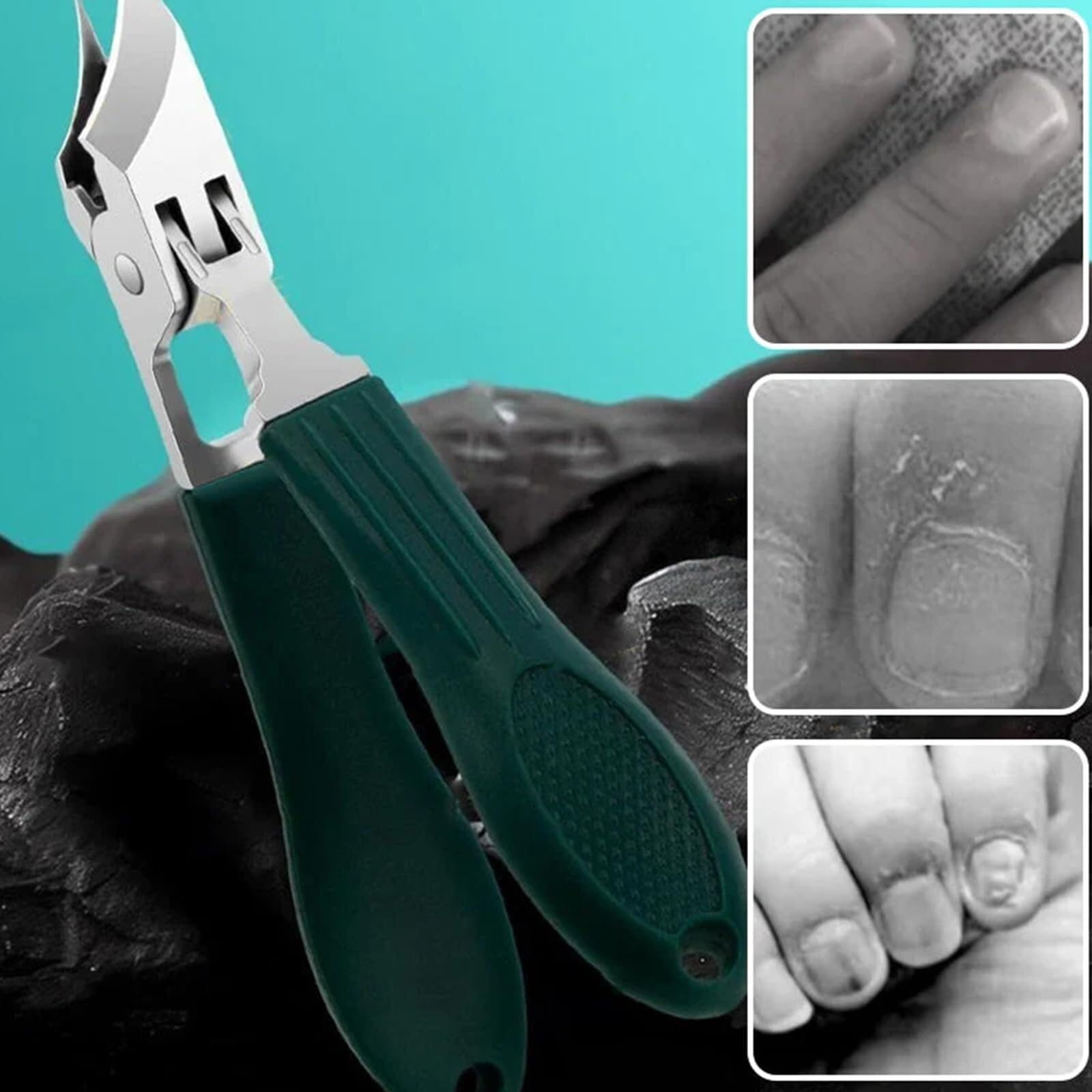 Super Scharfer Schräger Nagelknipser | 3-teiliges Set Mit Auffangbehälter | Edelstahl & Ergonomisch
