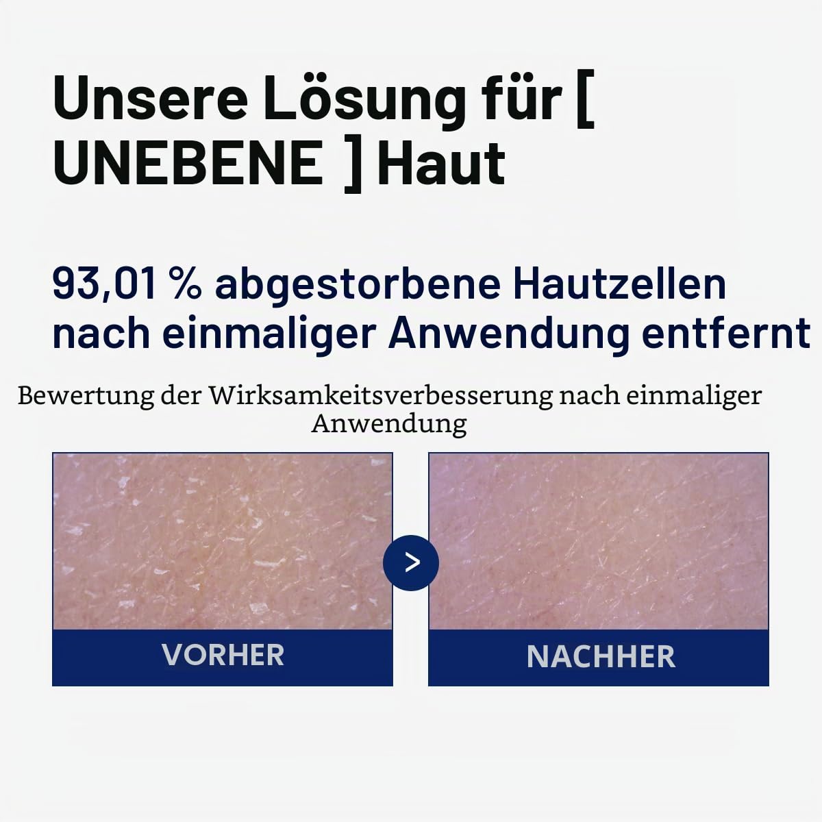 Mediheal Toner Pads Phyto Enzyme Exfoliating Peeling Pad Mit Lha & Papaya Enzyme Porenverfeinernd & Talgregulierend Vegan Mikrogeprägt Nicht Sensitive Pads (90 Stück) Weiß