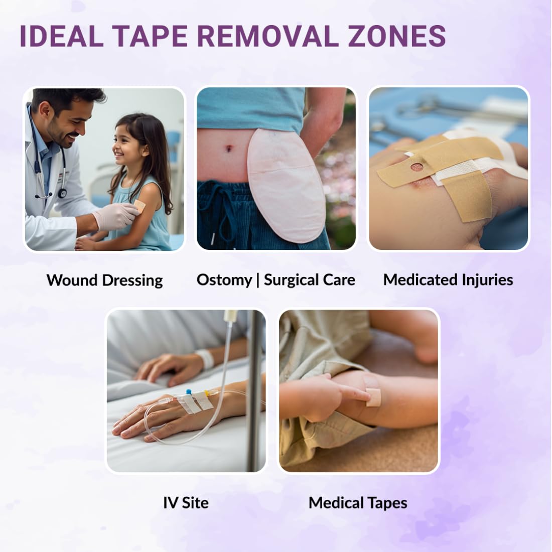 Soreze Cleanse Medical Adhesive Remover Spray | Alcohol Free & Safe on Skin | No Sting and Painless | Quick Dry & Non Sticky Formula | Pack of 1 | 70ml 2