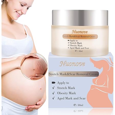 best stretch mark cream amazon