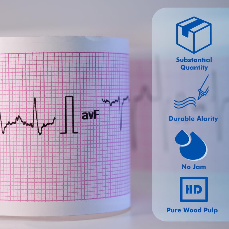 Image of OTICA ECG Thermal Paper Roll (50mm x 20mtr With Indicator) |Pack Of 10 Roll Thermal ECG Graph Paper Roll | Compatible with Standard Single /3 Channel ECG Machines