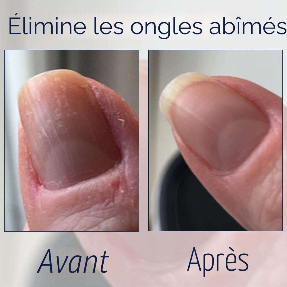 Herome 2-Pack 3-en-1 Nail Essentials Set (Rose) - Travel Set - Soin Réparateur pour les Ongles Cassés - Kit Avec Huile pour Ongles Abîmés, Sérum pour Cuticules et Durcisseur pour Ongles