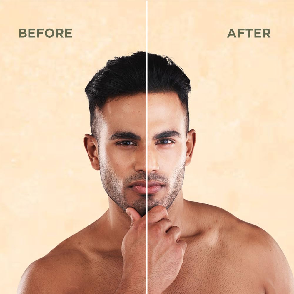 ASK Tinted Moisturizer for Men-30ml | Hydrating, Light Weight & Non-sticky | BB Cream Like Coverage | Improves Uneven Skin Tone | For All Skin Types - Image 5 thumbnail