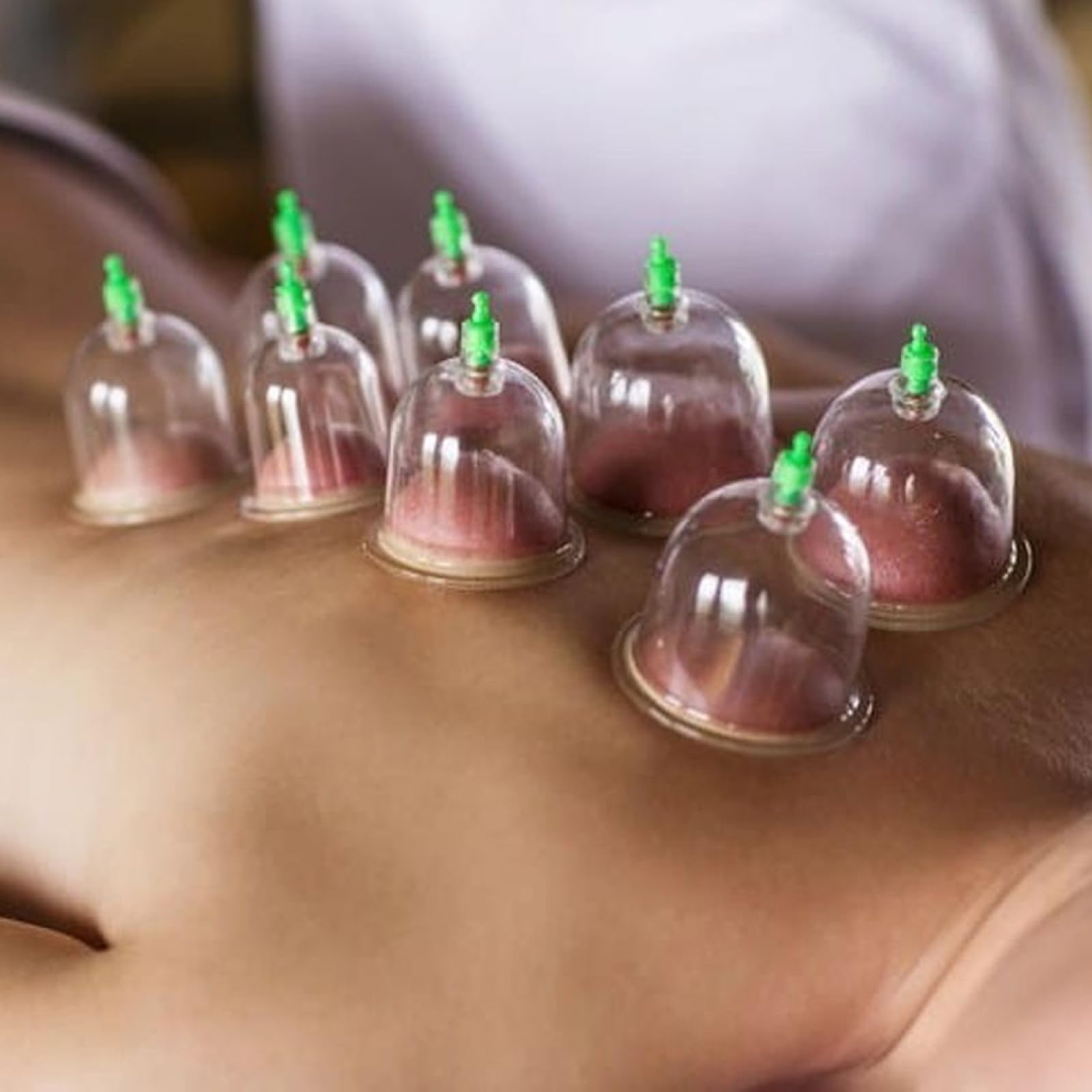 100er Schröpfgläser + Pumpe + 100er Derby Rasierklingen Schröpfen Set, Cupping Cups, Hijama Cupping, Hacamat Kupası Seti (6cm)