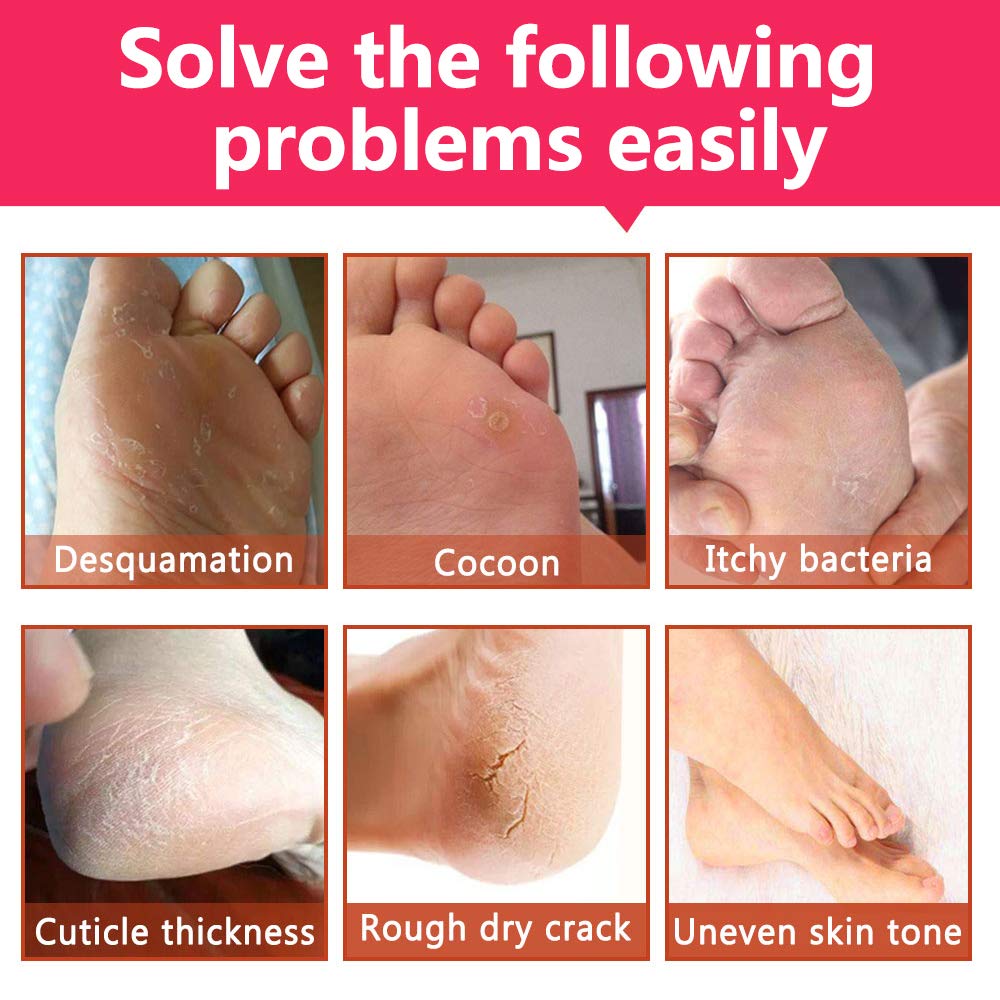 Amazon Foot Peel Mask Repair