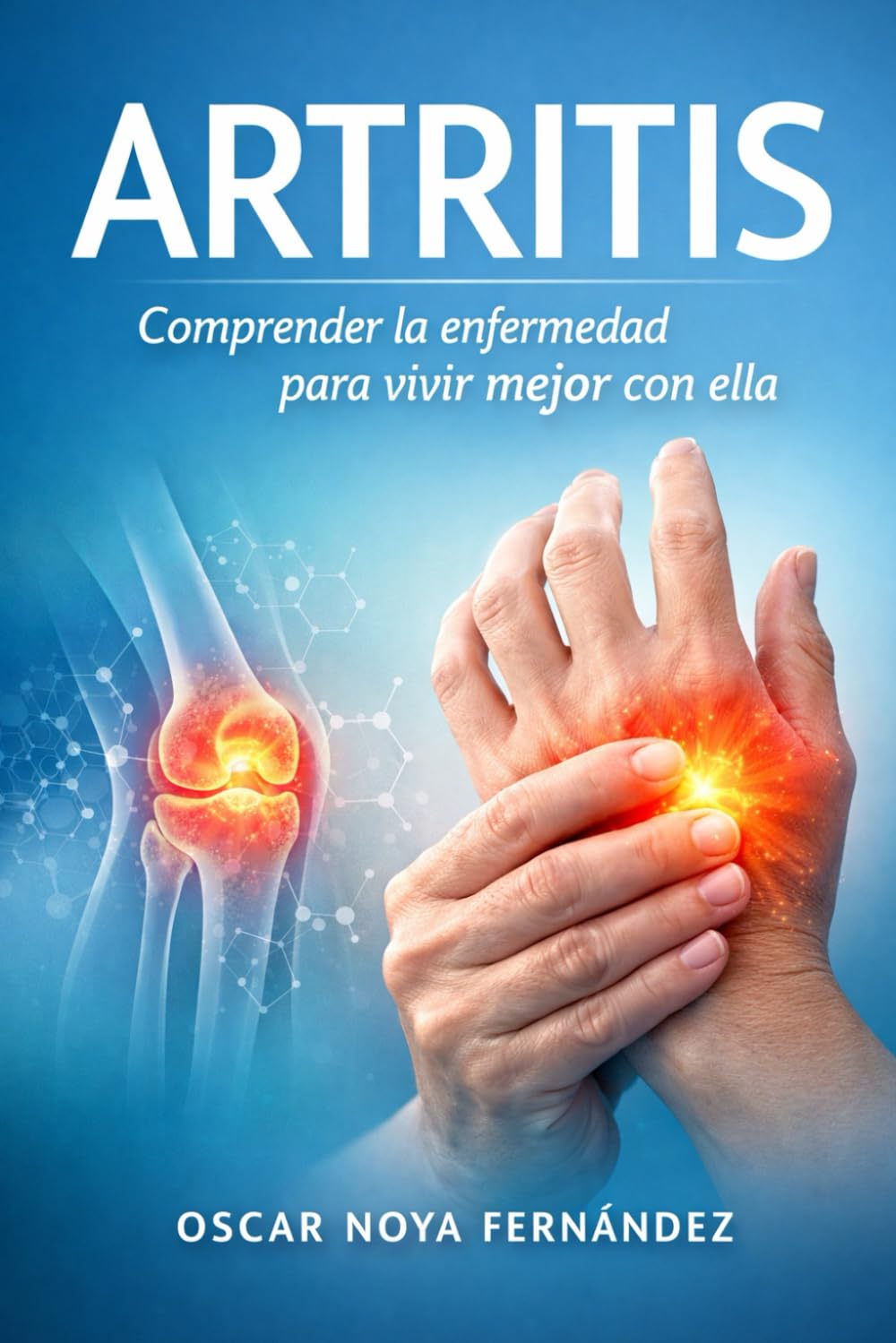 ARTRITIS: Comprender la enfermedad para vivir mejor con ella