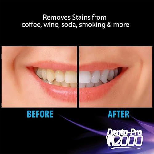 Miniatura 3 de DentaPro 2000 Kit de blanqueamiento dental 3D - Adición de lujo incluye luz LED, (2) jeringas de gel de 0.2 fl oz, bandeja moldeable personalizada