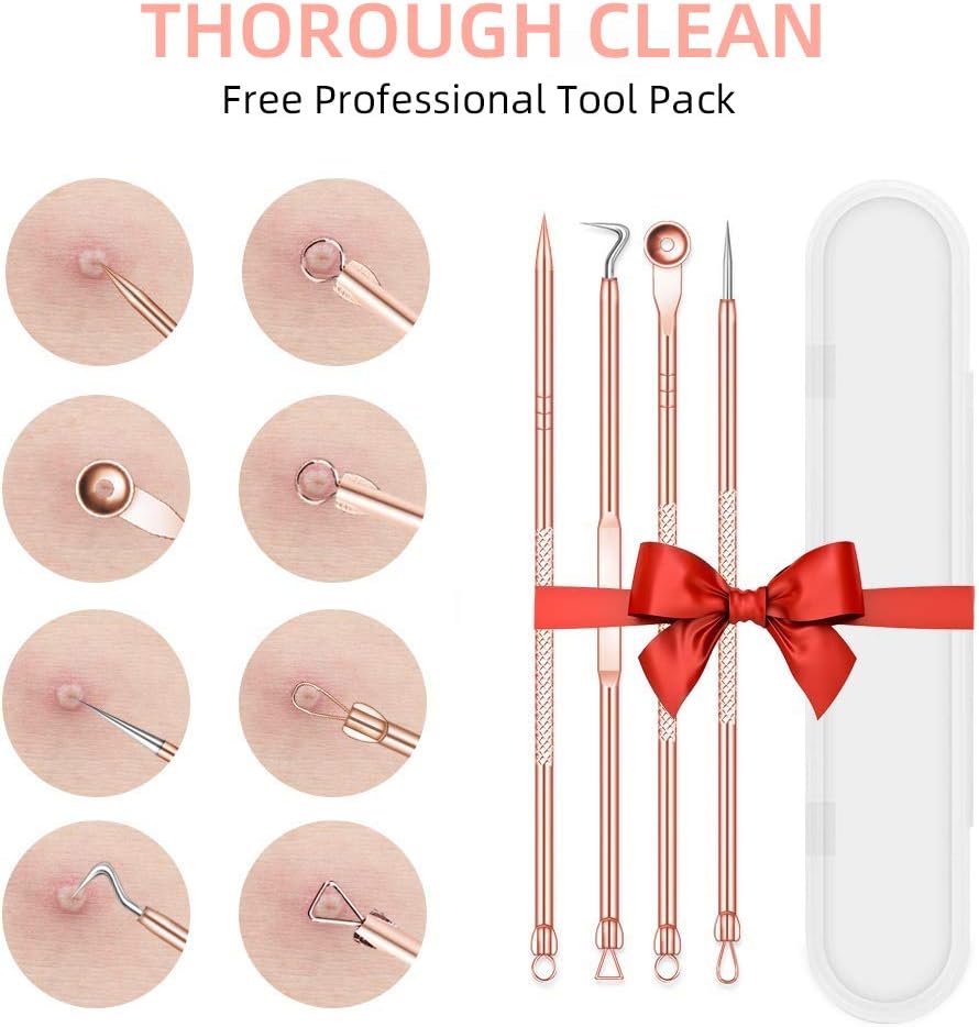Blackhead Remover, Pore Vacuum with Camera,Acne Extractor - Blackhead Cleaner with 4 Probes and 3 Adjustable Strength Power,USB Rechargeable for All Skin : Beauty & Personal Care