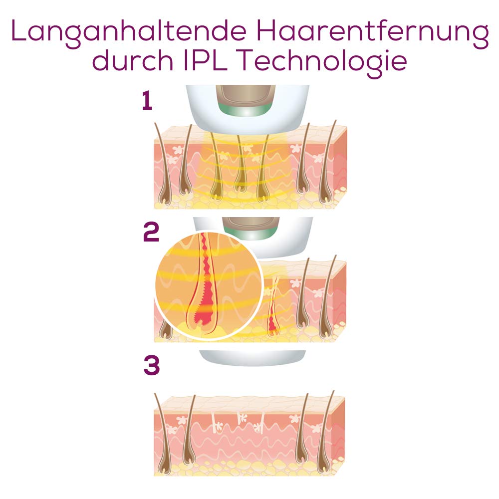 Beurer IPL 5800 Pure Skin Pro Haarentfernungsgerät, dauerhafte Haarentfernung durch IPL-Technologie, für Körper, Gesicht, Bikinizone, mit App, schwarz