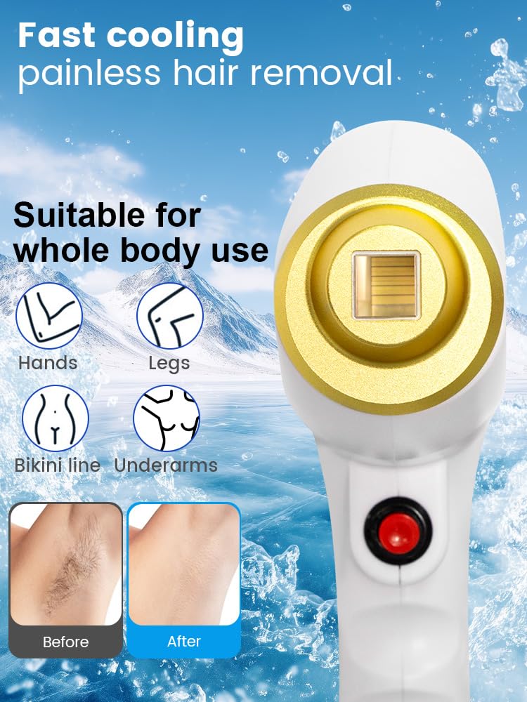 Epilazione Permanente Laser Diodo 808nm per Corpo Viso e Gambe