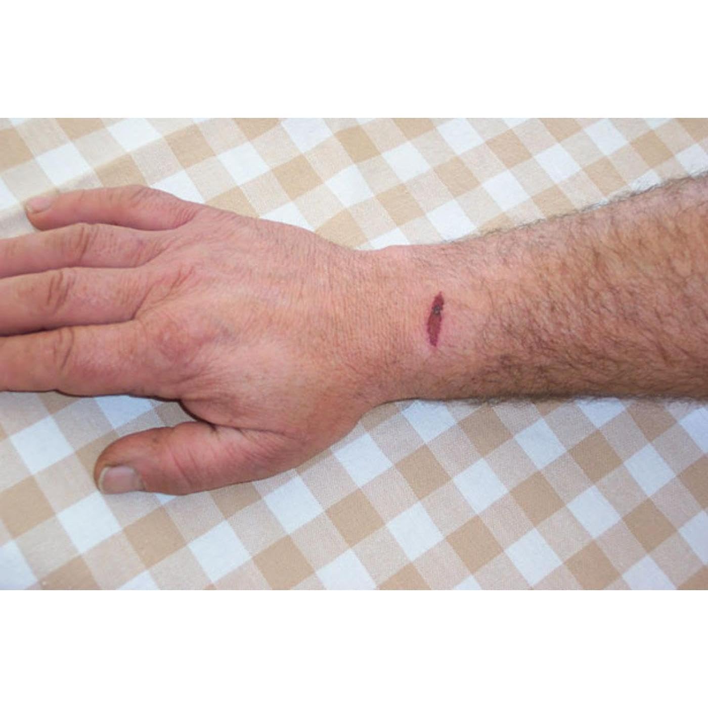 Noesitherapy Mind Over Matter Pain Control & Psychological Healing Self-Hypnosis