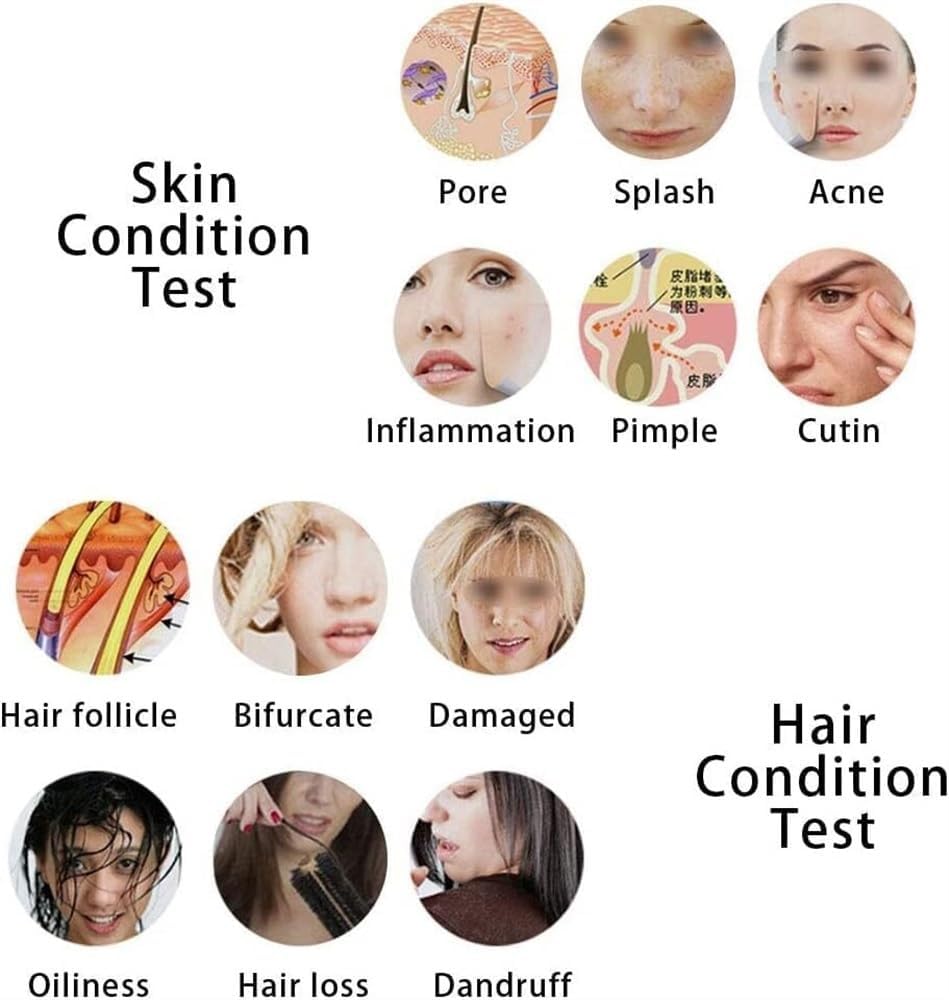 Skin Diagnosis Hair Analyzer, 5 Inch LCD Screen Digital Skin Diagnosis Scanner System, Skin Hair Blackhead Scalp Detector Skin Hair Scalp Detector