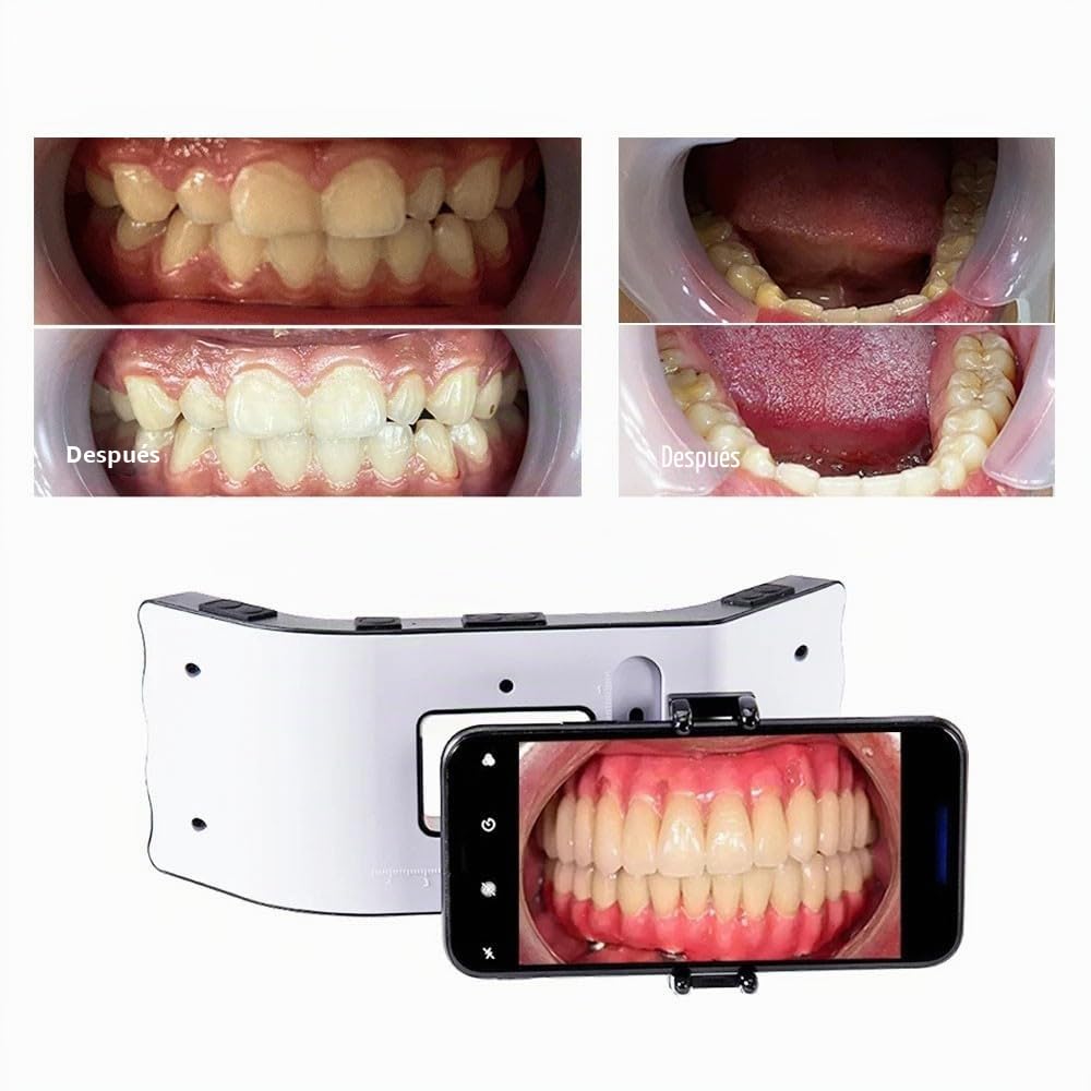 Luz de Flash Dental, lámpara de llenado Oral Equipo de fotografía | Luz ambiental Lámpara fotográfica Herramientas de odontología
