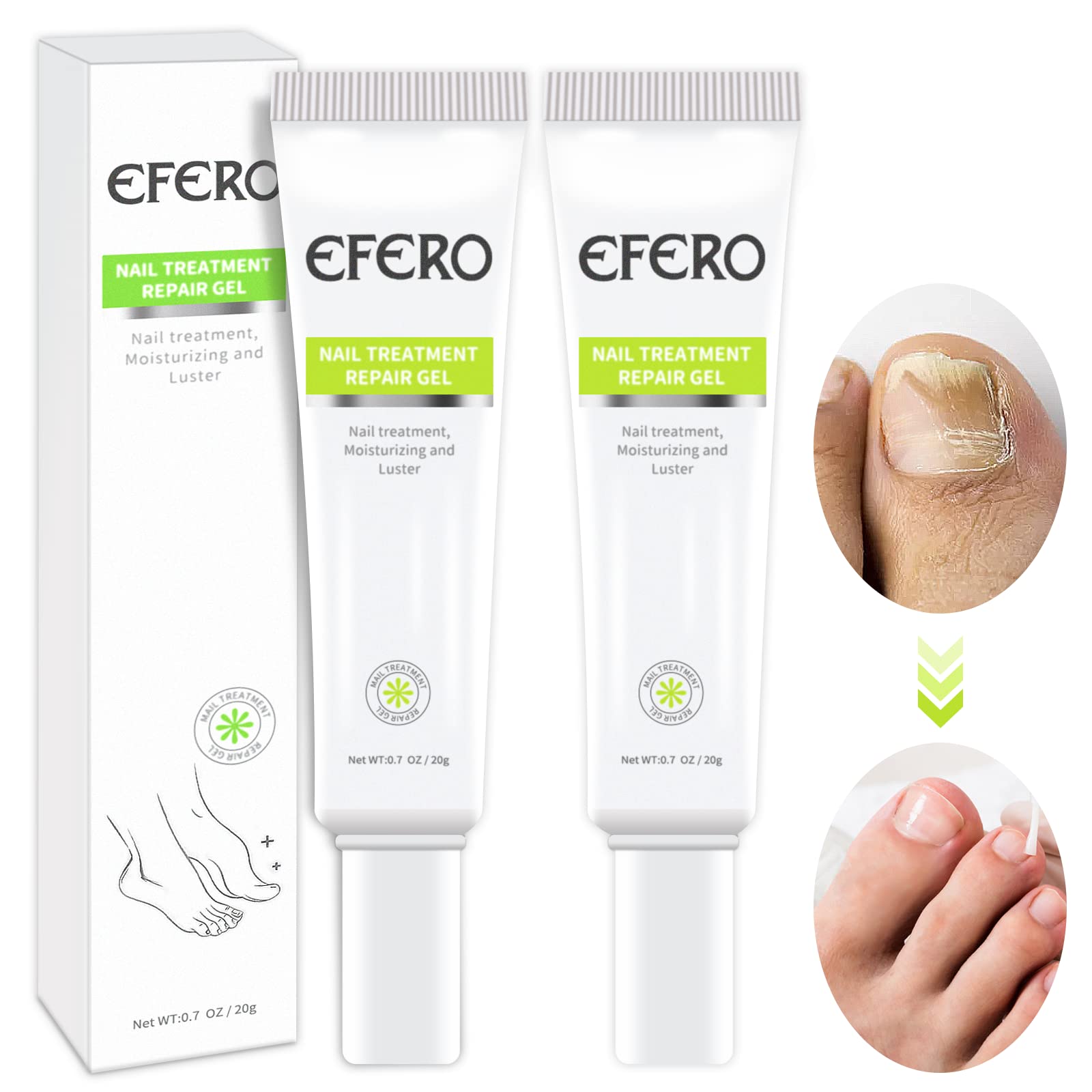 Buy 2pack Fungal Toenail , Fungus Nail Cream, Fungal Nail for Toenails