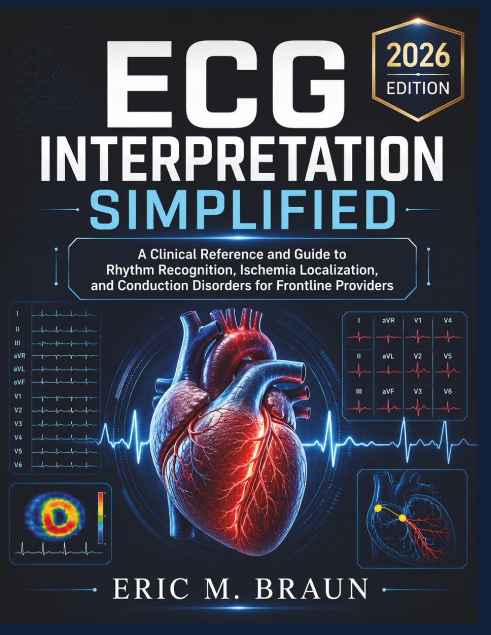ECG Interpretation Simplified: A Clinical Reference and Guide to Rhythm Recognition, Ischemia Localization, and Conduction Disorders for Frontline Providers