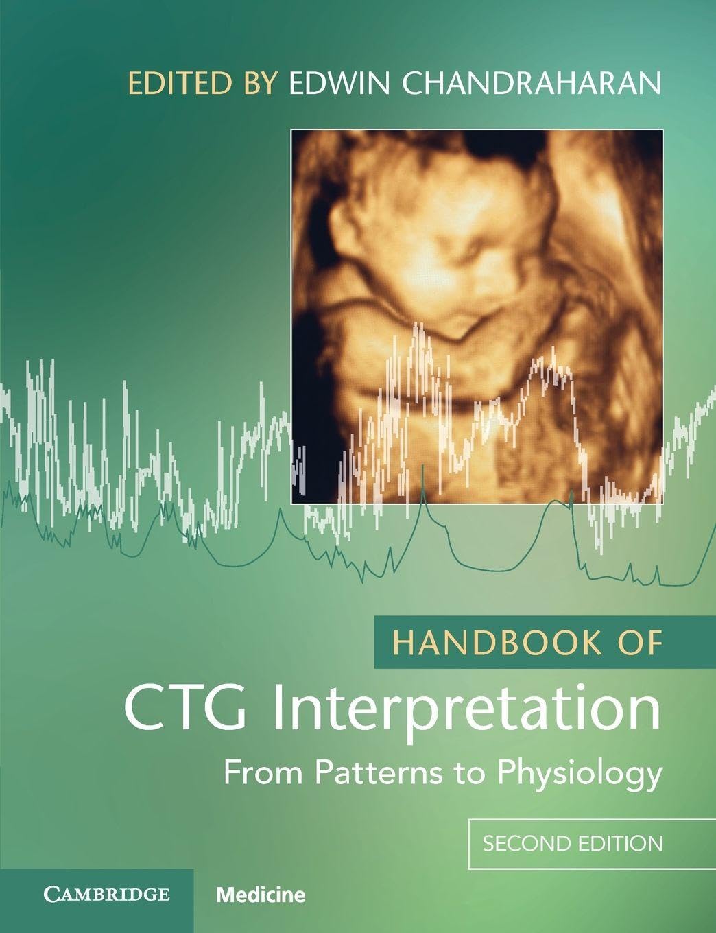 Handbook of CTG Interpretation: From Patterns to Physiology
