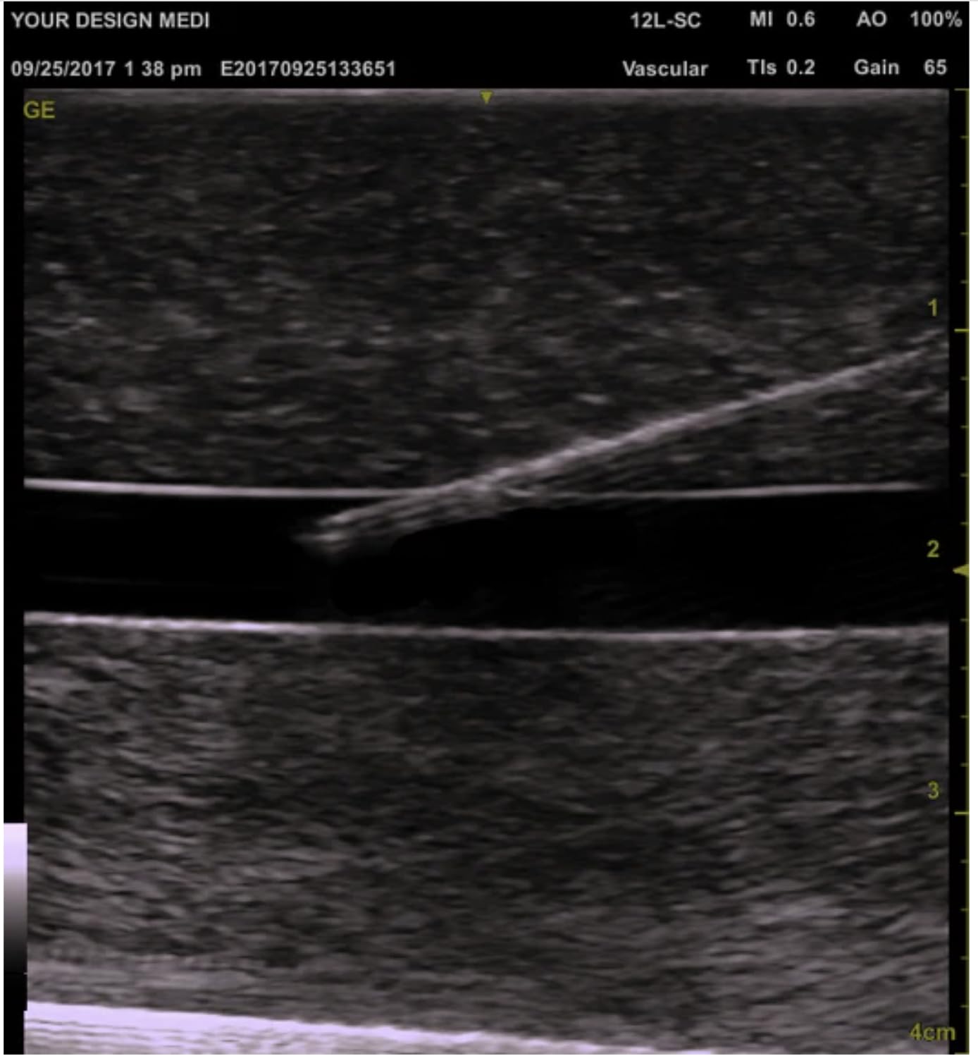 Ultrasound Guided Phantom IV Venous Trainer Medical Simulation - Practice Phlebotomy Drawing Blood or Placing an IV - Hand Made in The USA by Your Design Medical
