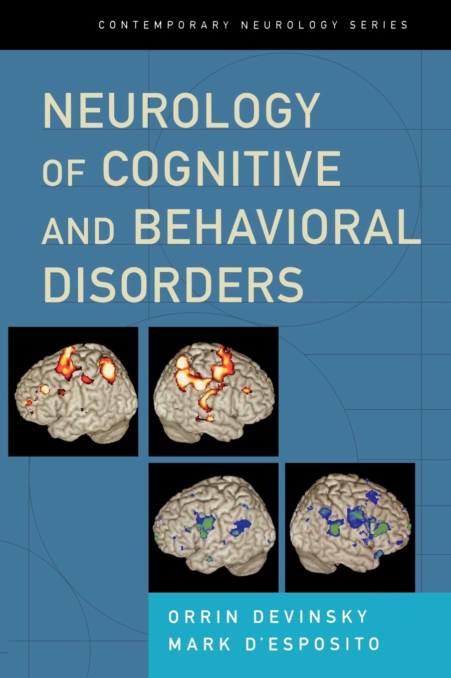 Neurology of Cognitive and Behavioral Disorders: 68 (Contemporary Neurology Series)