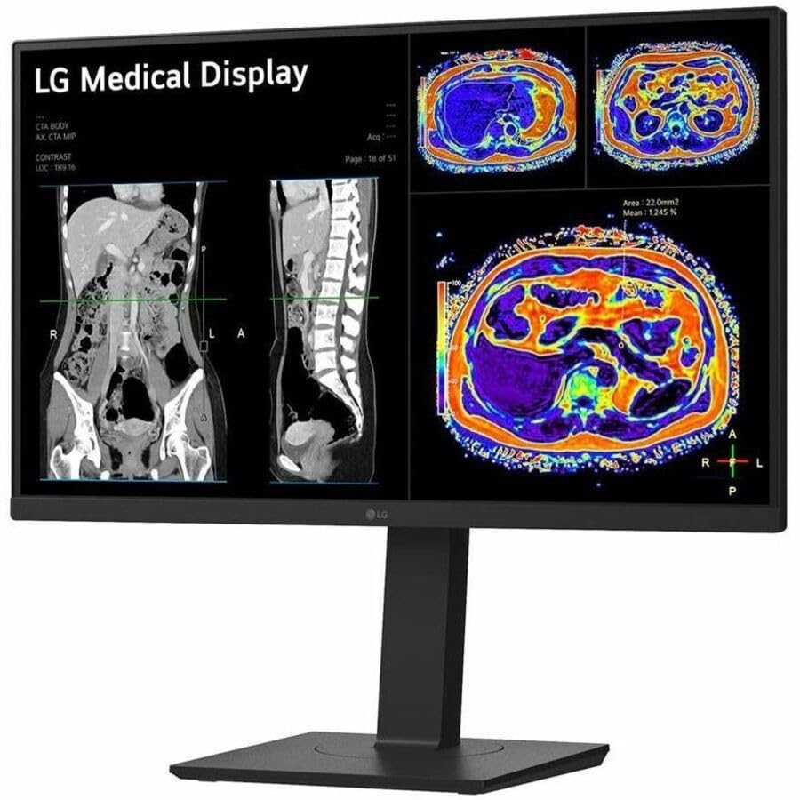 Image of LG 27HS713C-B 27 inch Class Webcam 4K UHD LED Monitor - 16:9 - Black