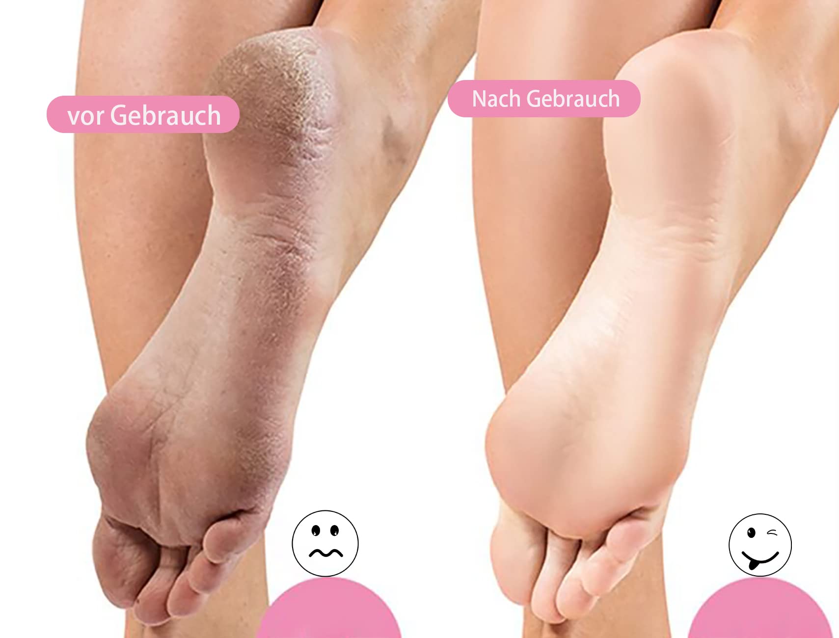 rappe pies pedicura,rape pies,Lima de pie de acero inoxidable, se puede utilizar para el cuidado de los pies, corte láser de doble cara impermeable y antioxidante, no es fácil de ocultar la